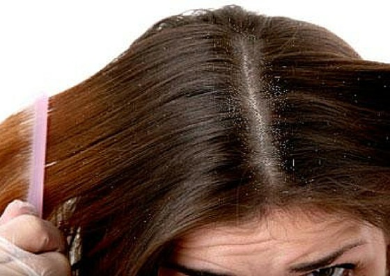 Common Hair Problems And Their Treatments  Vedix