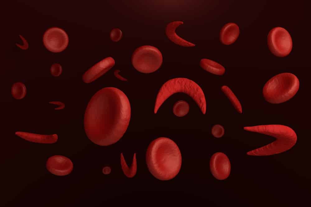 Budget: Centre aspires to eradicate sickle cell anemia by 2047