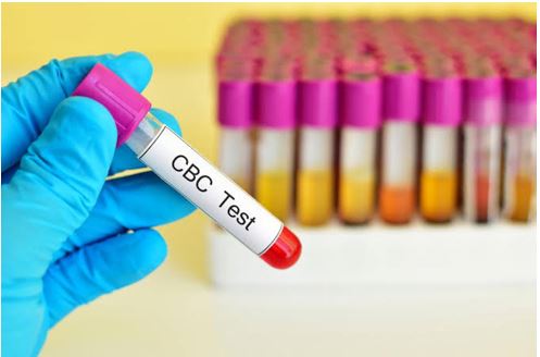 What is the Use of CBC Blood Test?