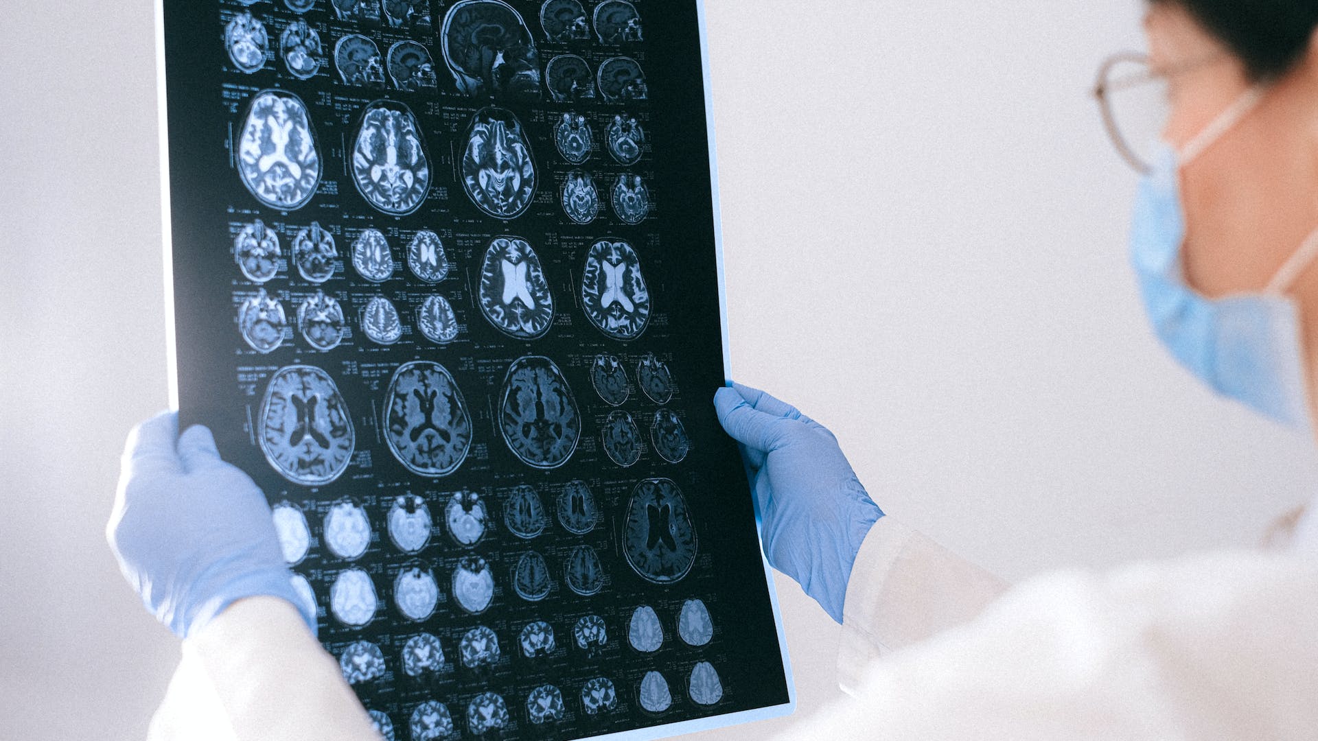 Artificial intelligence lowers barrier to ultrasonic brain treatment