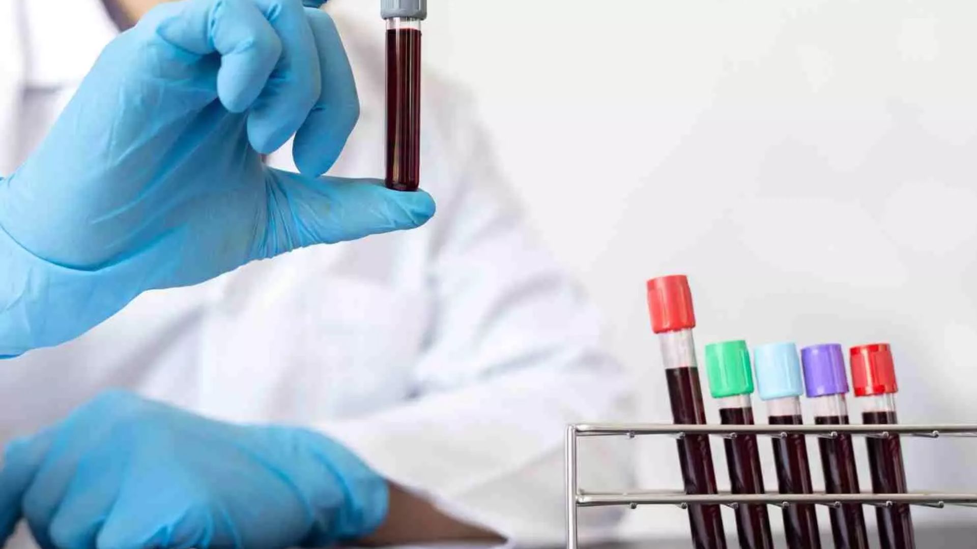 Researchers Introduce Rapid Blood Test for Swift Sarcoidosis Diagnosis