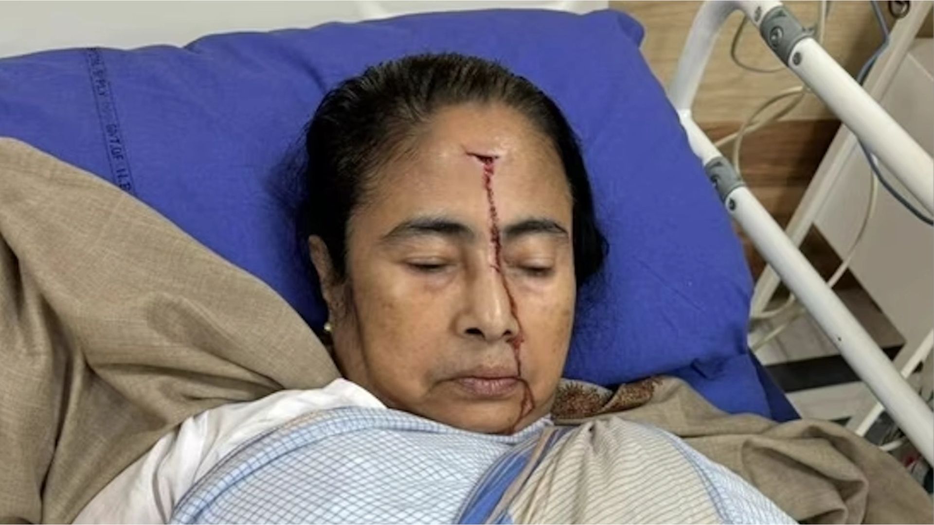 Mamata Banerjee’s Health Stable, Doctors Maintain Close Monitoring