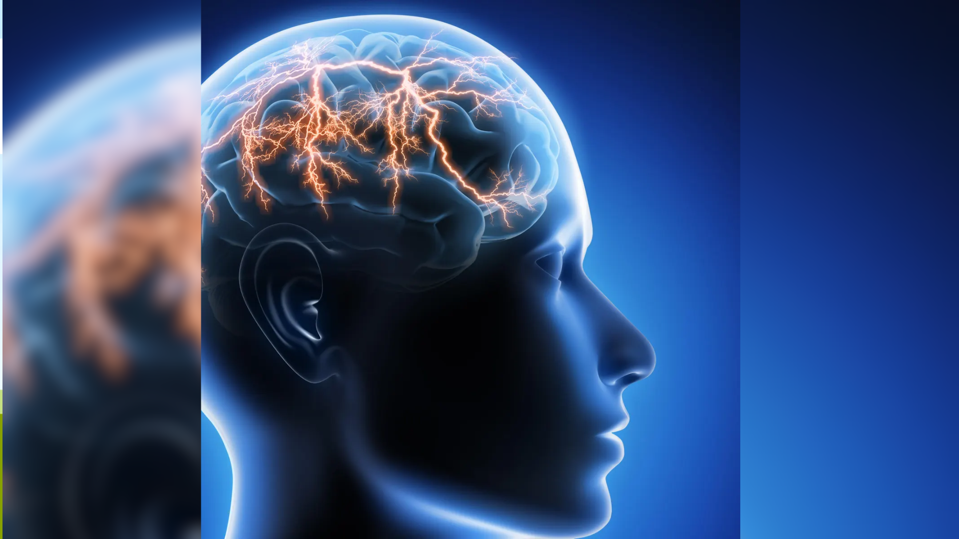 WHO Study Reveals Over 3 Billion Affected by Neurological Conditions