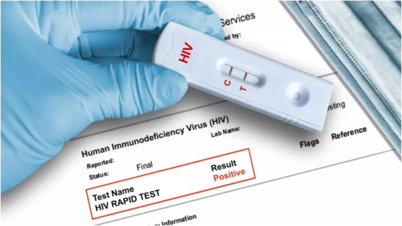 828 Students Found HIV-Positive In Tripura, 47 Fatalities Recorded; What Are Its Causes And Solutions?
