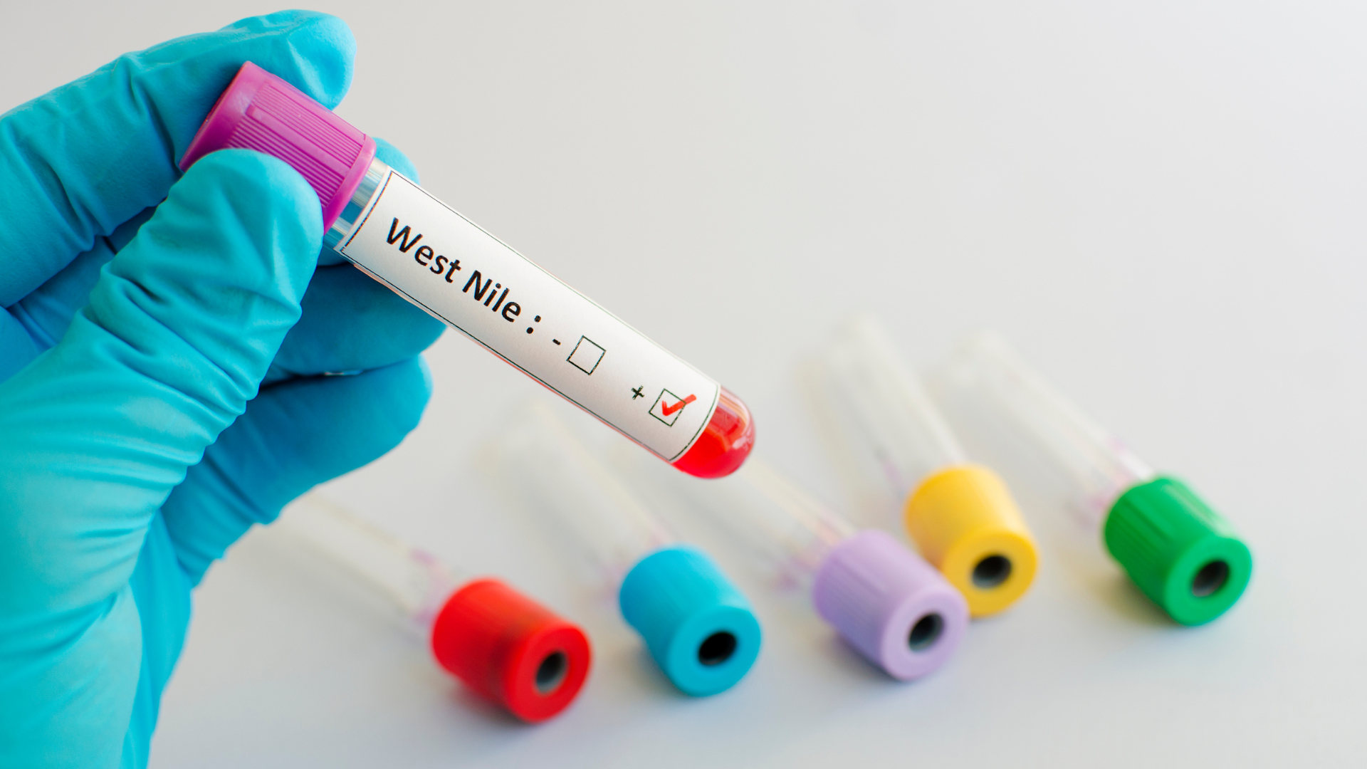 What Is West Nile Virus? Understand Its Symptoms, Causes, Treatment & Prevention