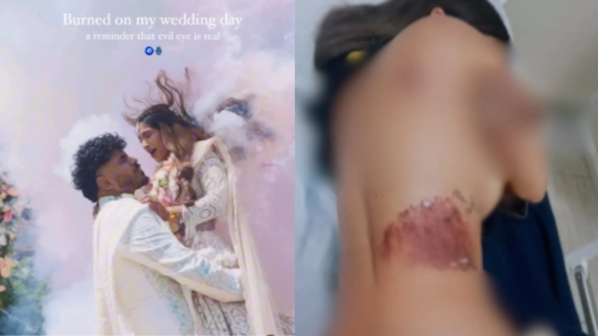 Viral Video! Wedding Couple Photoshoot Ends Up Brutally Burning The Bride, Watch