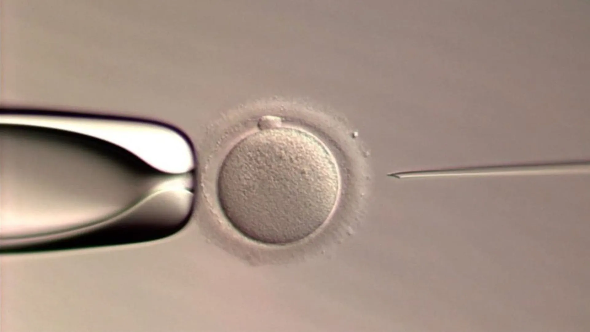 World’s First Baby Born Via Fully Automated AI-Driven IVF, Ushering In New Era Of Reproductive Medicine