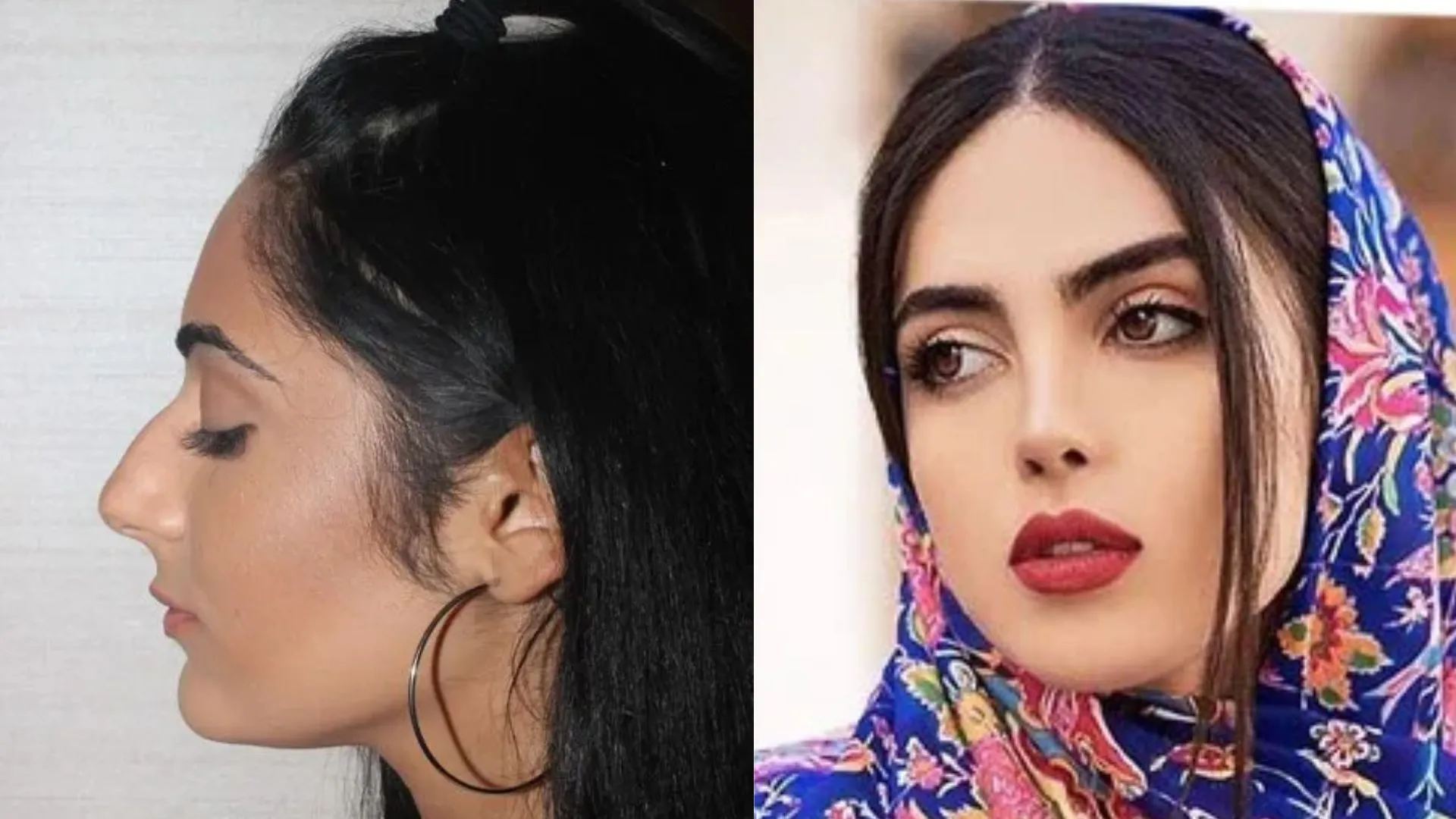 Why Iranian Women Are Choosing To Get Nose Jobs Letting Go Their Persian Nose