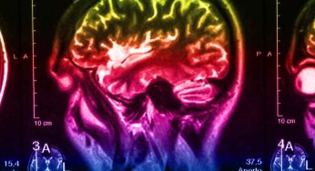 Study Finds Brain Scan Clues Behind Parkinson’s Drug Failures