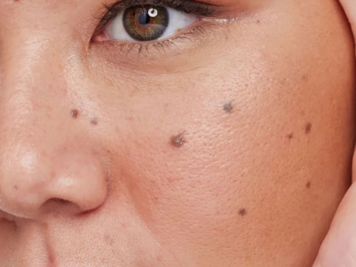 Introduction To Moles And Their Symbolism