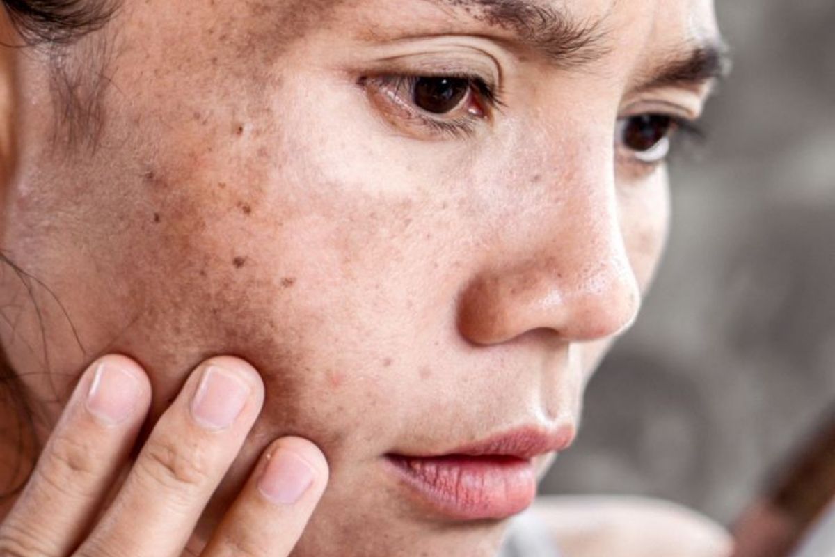 Dull, Tired-Looking skin