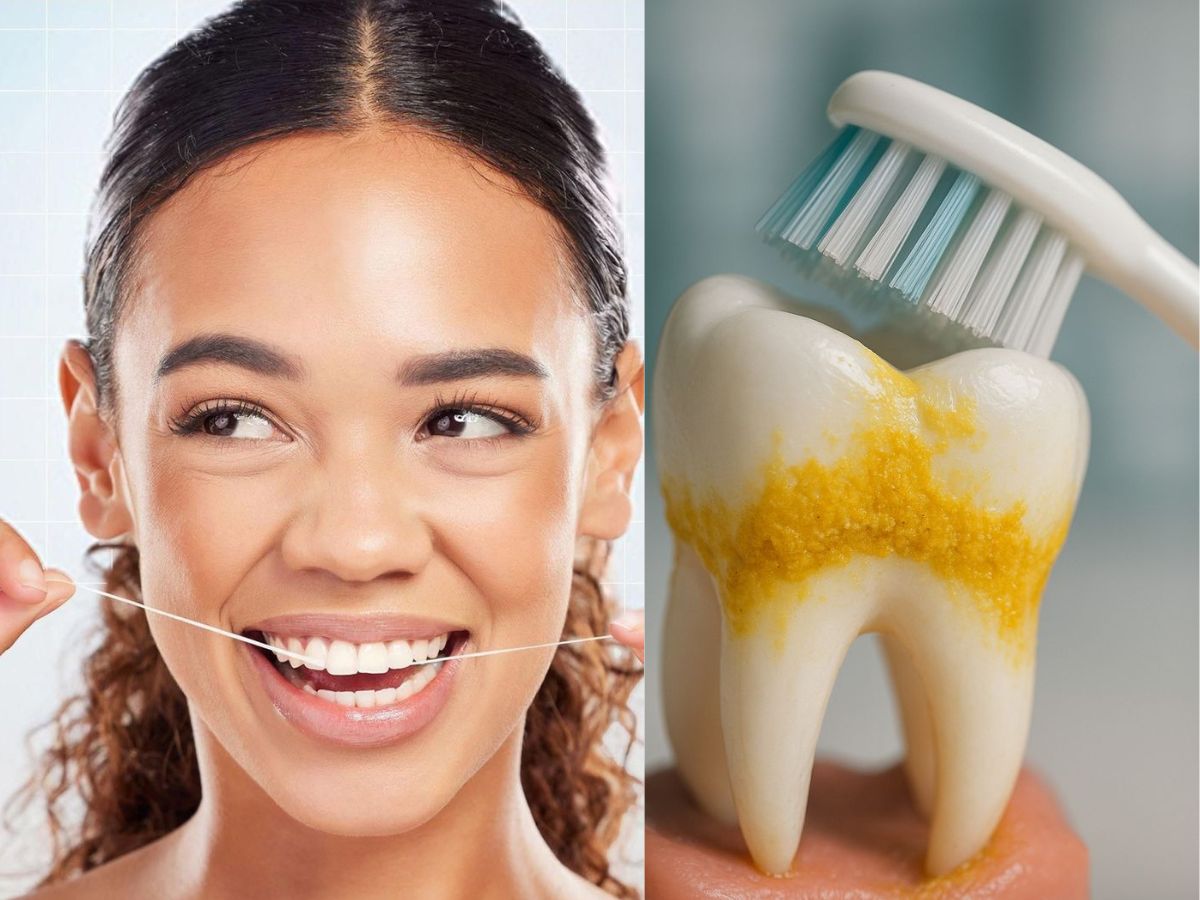 Floss daily to remove plaque