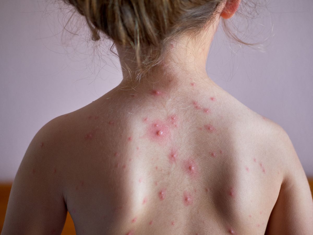 Fruits (Bananas, Apples, Berries)