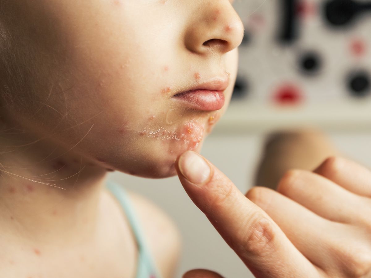 Vegetables (Steamed or Boiled)