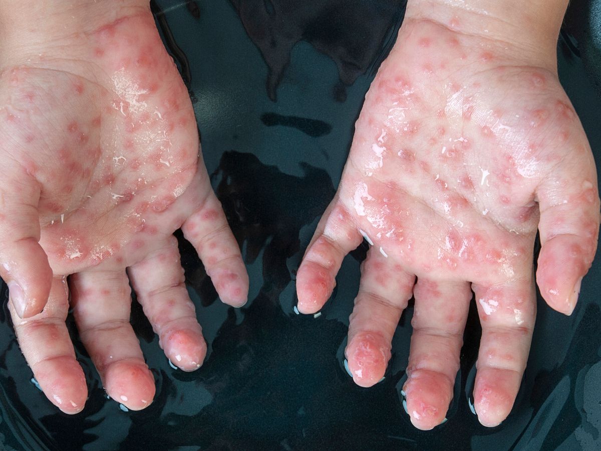 Protein Foods (Lentils, Beans, Tofu, Chicken)