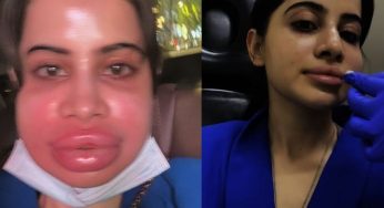 Unfiltered Beauty Wave: Mallika Sherawat’s No-Botox Pledge & Uorfi Javed’s Filler-Free Comeback