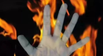 Odisha 15-Year-Old Burn Victim Admitted In AIIMS Delhi, Condition Critical: Report