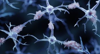 Memory Loss Mystery: Scientists Find Hidden Protein Triggers