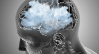 Brain Fog That Won’t Go Away? It Might Be a Serious Warning Sign From Your Brain