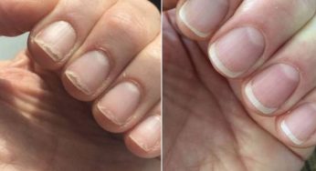 Is Your Nail Growth Rate a Hidden Clue to Aging? Find Out What It Reveals