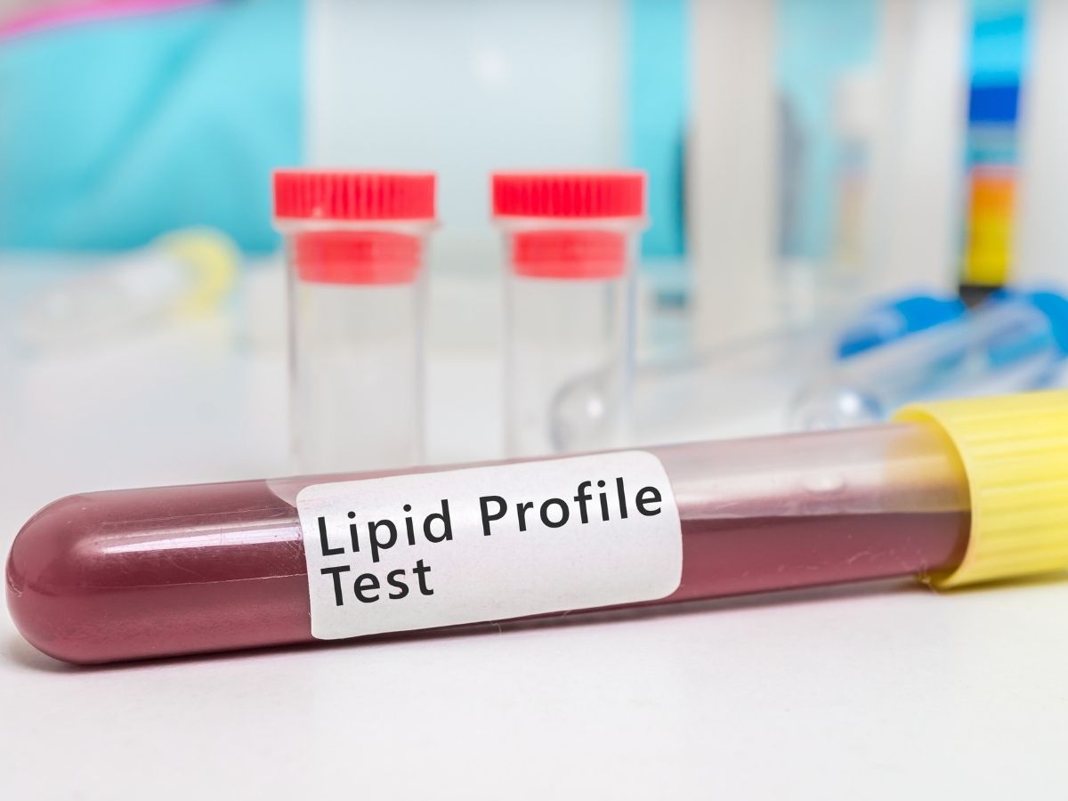 Elevated LDL cholesterol