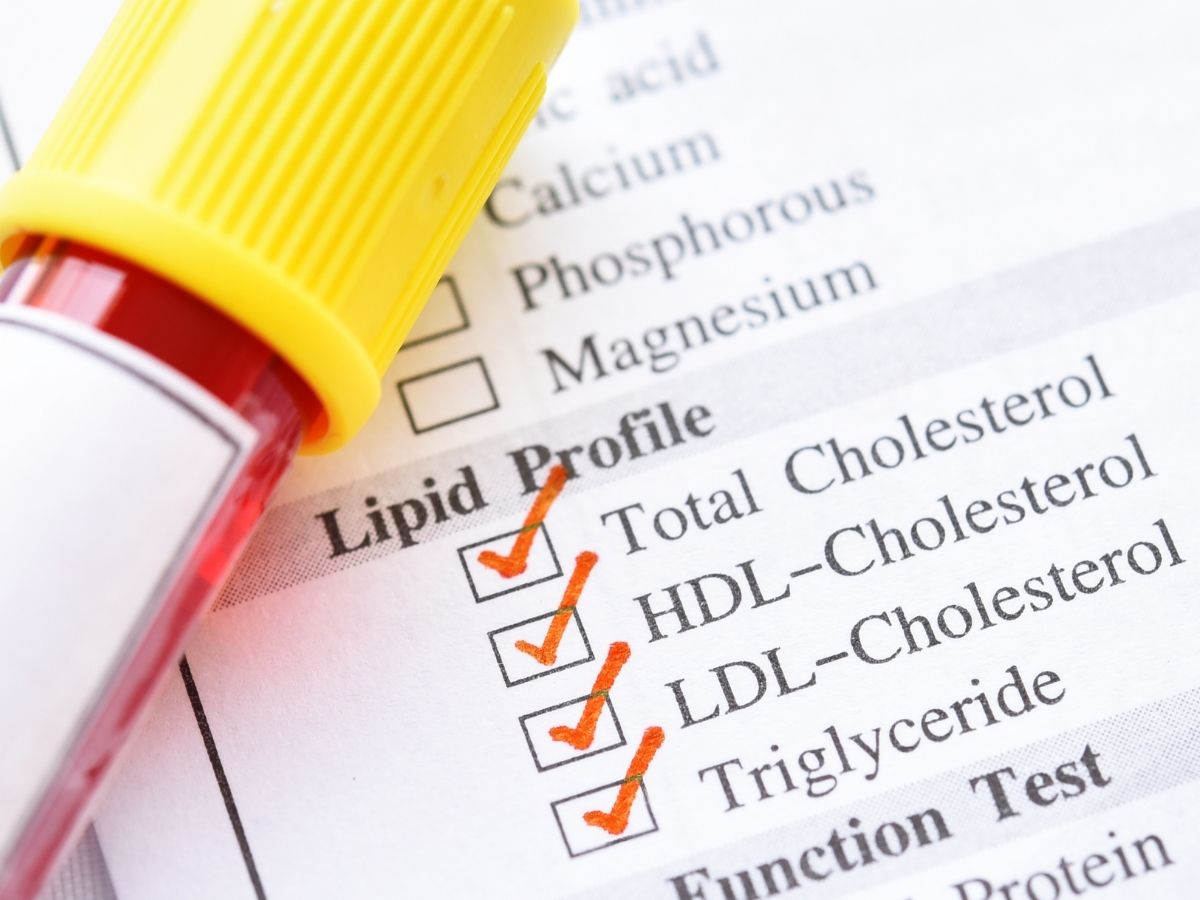 Positive effect on other lipids