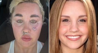 Did Amanda Bynes Go Under The Knife Again After Blaming It All On Hollywood? New Video Leaves Fans In Shock