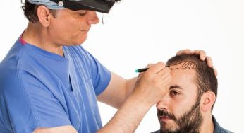 Think Hair Transplants Are Fake Or Painful? Here’s What Actually Happens