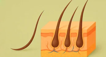 Traya Hair Treatment Reviews: What to Expect from the Personalized Regimen