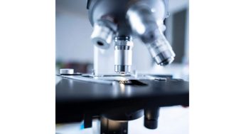 Scientists find over 200 hidden proteins that may drive Alzheimer's: Study