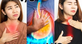 GERD, Heartburn, Acid Reflux: Key Differences, Causes & Symptoms Explained