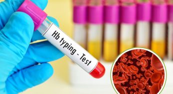 Top 6 Non-Vegetarian Foods to Boost Haemoglobin and Beat Anemia