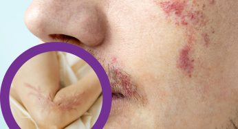 10 Birthmarks That Are Believed to Be Scars from Past Lives