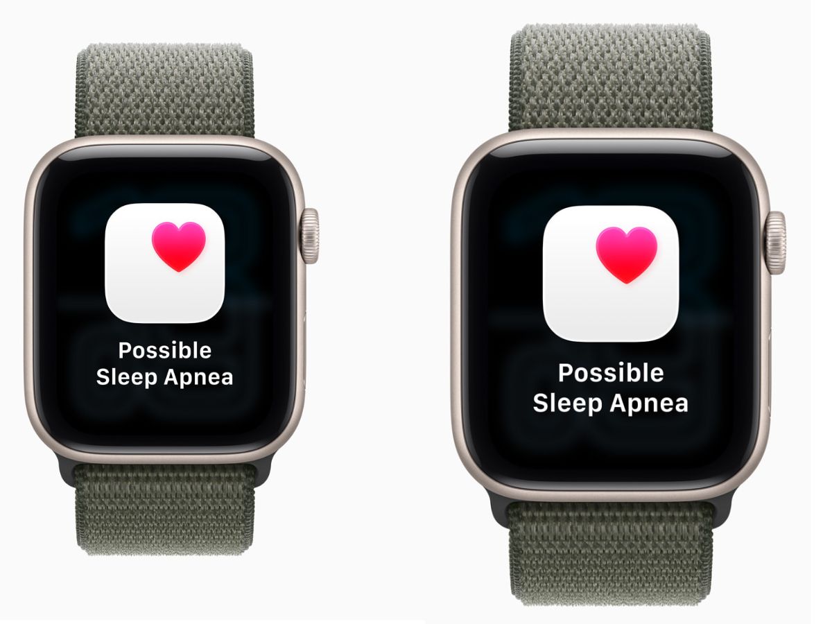 Apple Watch Series 11: Price Range