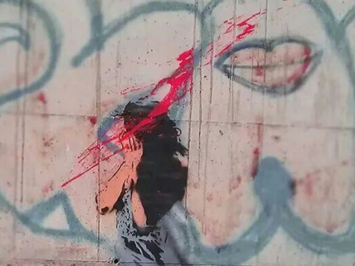 Delhi University Student Attacked with Acid by Stalker, Campus Outraged