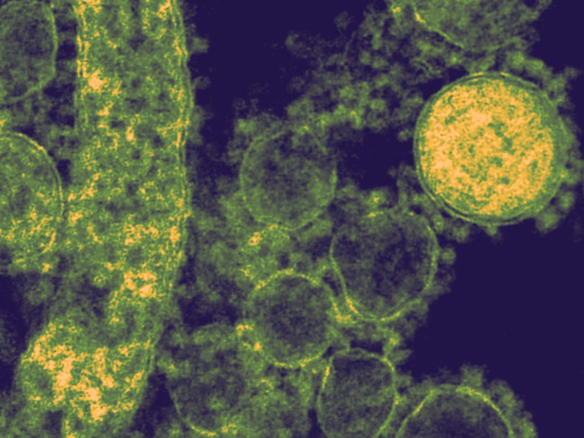 India’s Most Dangerous Superbugs: The Hidden Threats Behind the Resistance Crisis