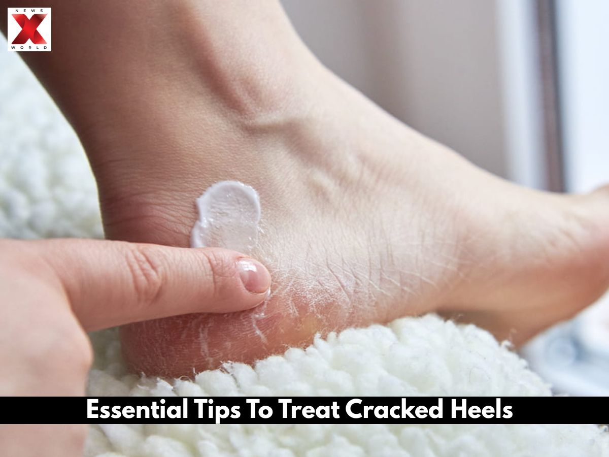 Cracked Heels In Winter? Try These 5 Simple Home Remedies
