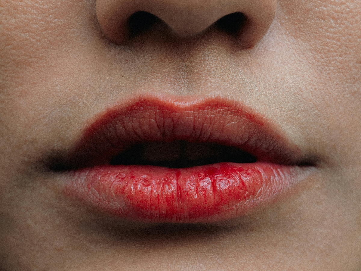 Why Lip Care Matters