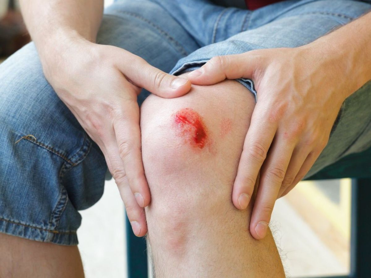 Slow Healing Wounds or Cuts