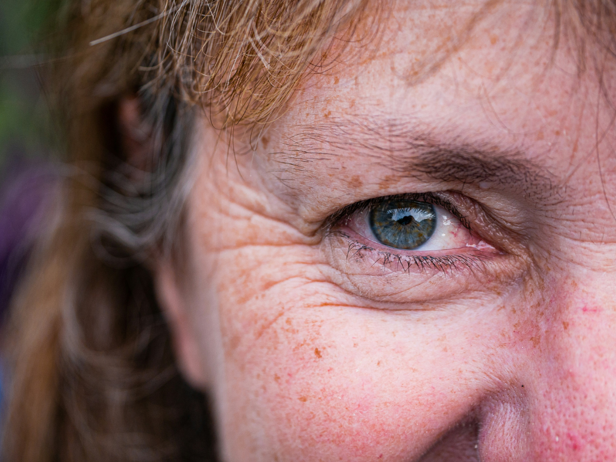 Prevents Premature Aging