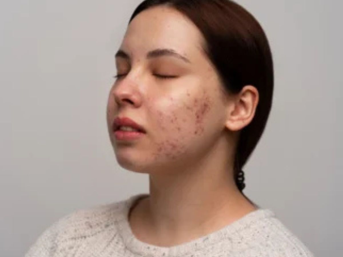 Can Cause Allergic Reactions