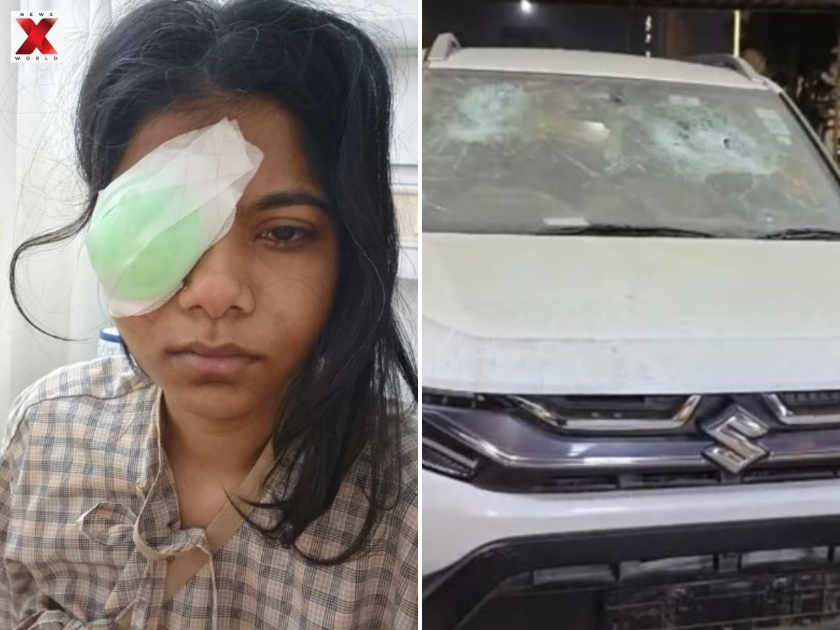 HR professional from Mumbai, was severely injured (PHOTO: X)