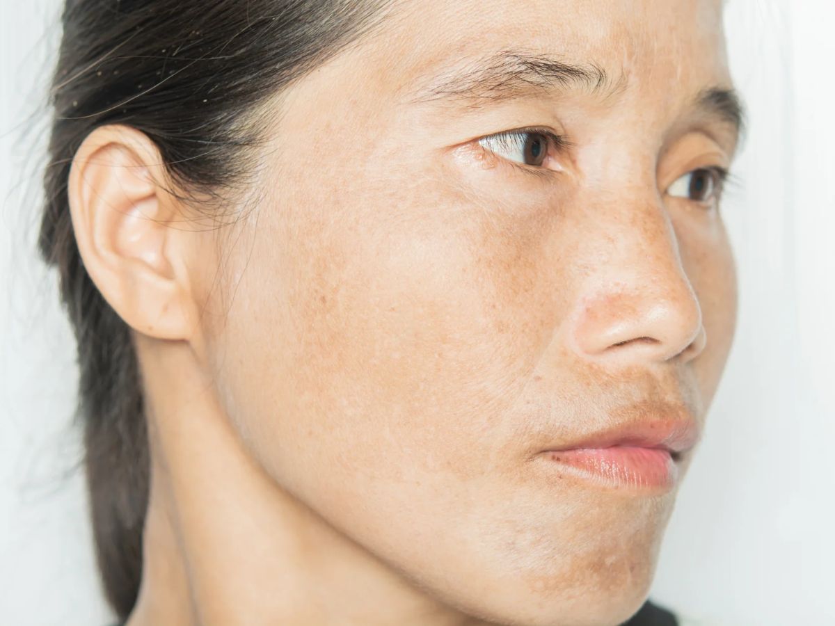 Mild Exfoliation for a Natural Glow