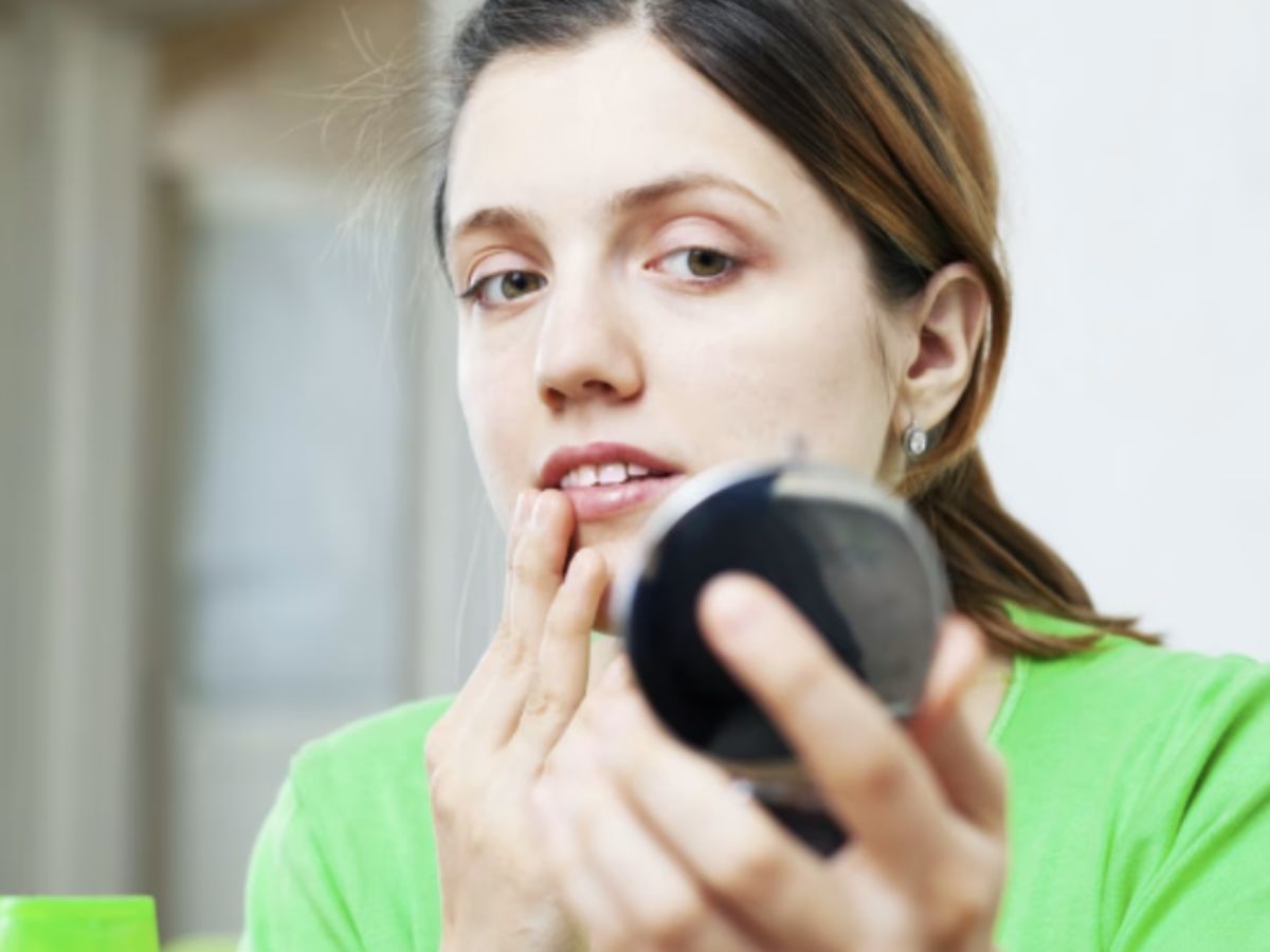 Excess Facial and Body Hair Growth