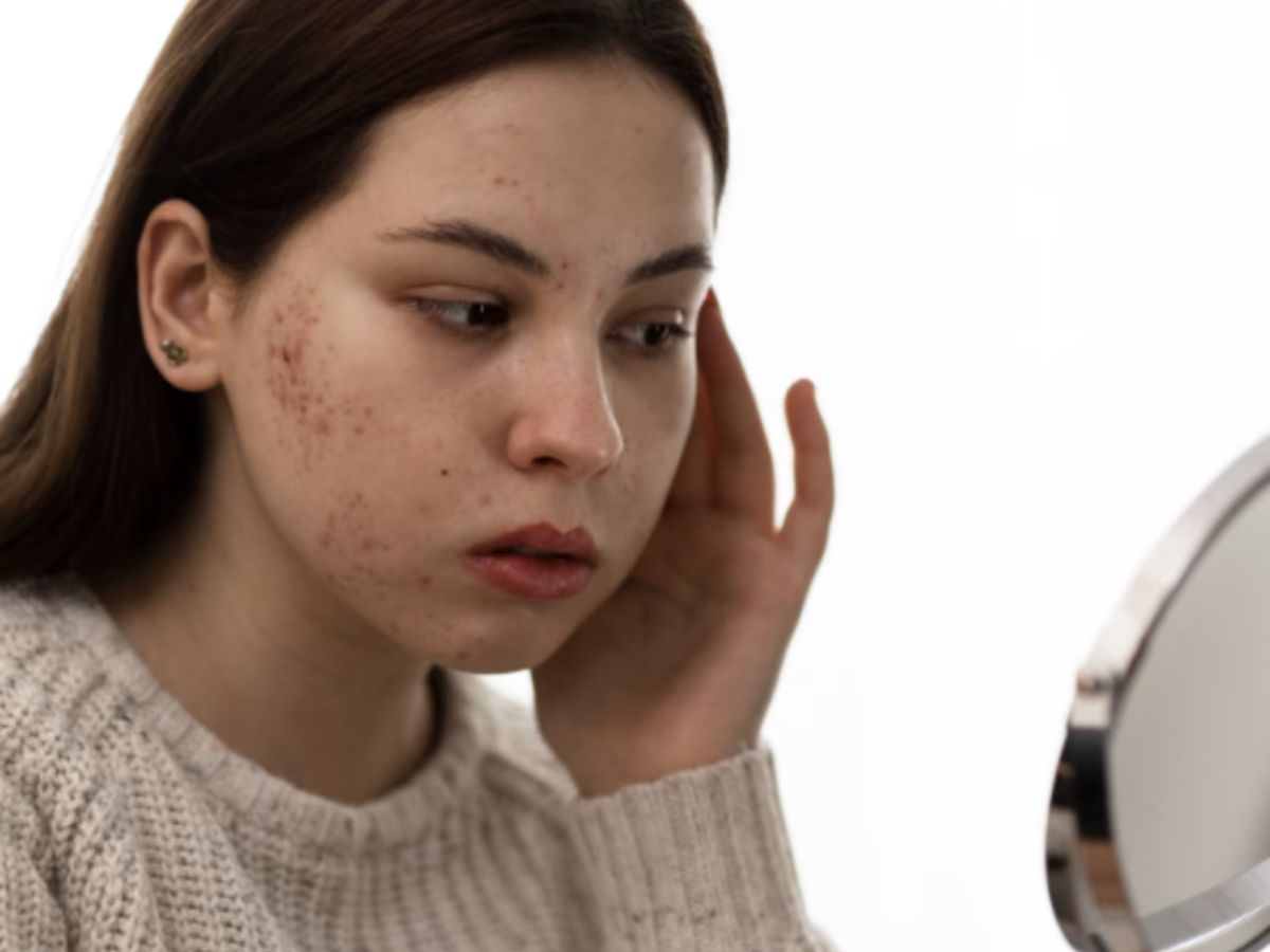 Dark Patches on Skin