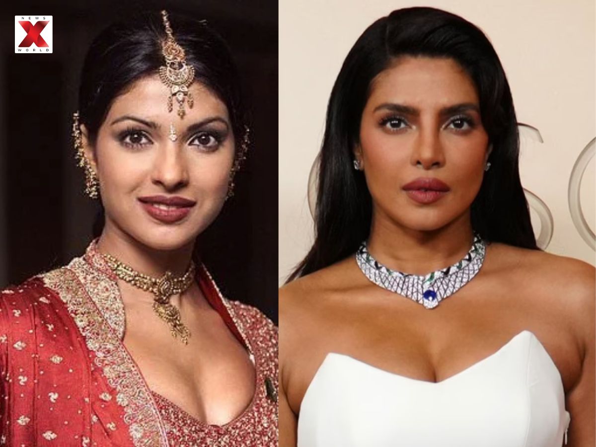 Priyanka Chopra Nose Surgery