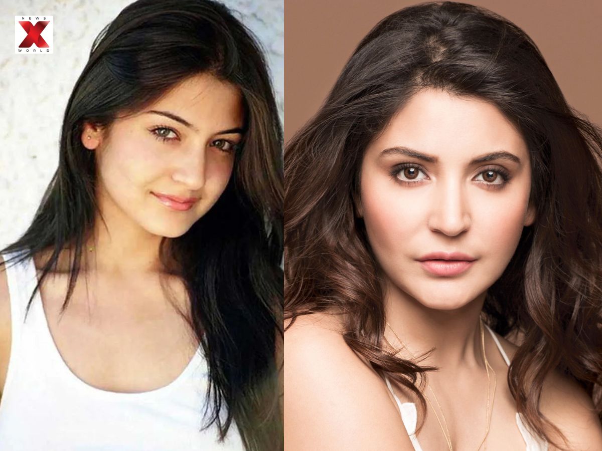 Anushka Sharma Lip Controversy