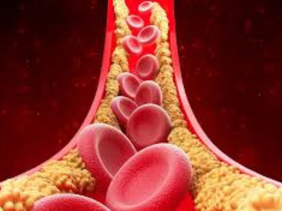 Exercise and Weight Management