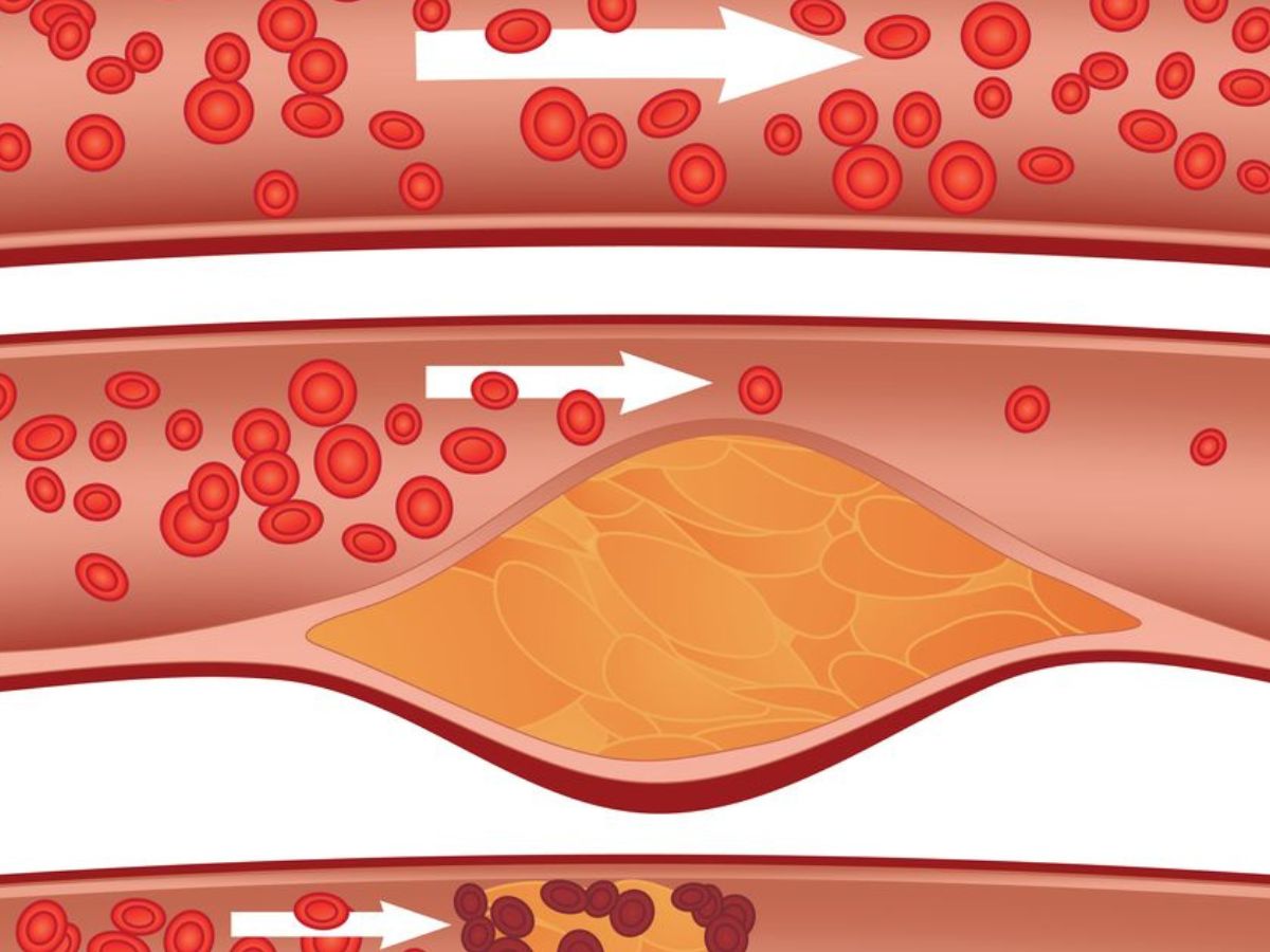 Healthy Lifestyle Habits