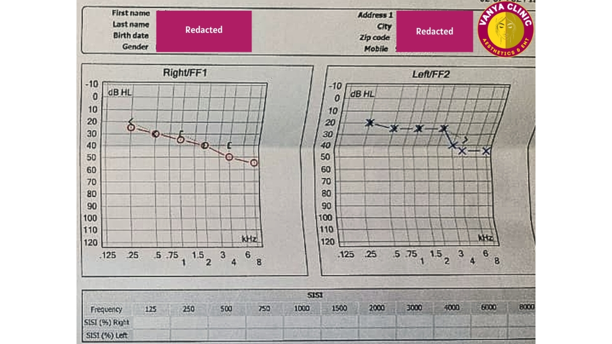 Dr. Purodha Prasad, ENT Specialist in Delhi Restores Sudden Hearing Loss in Patient Within 7 Days